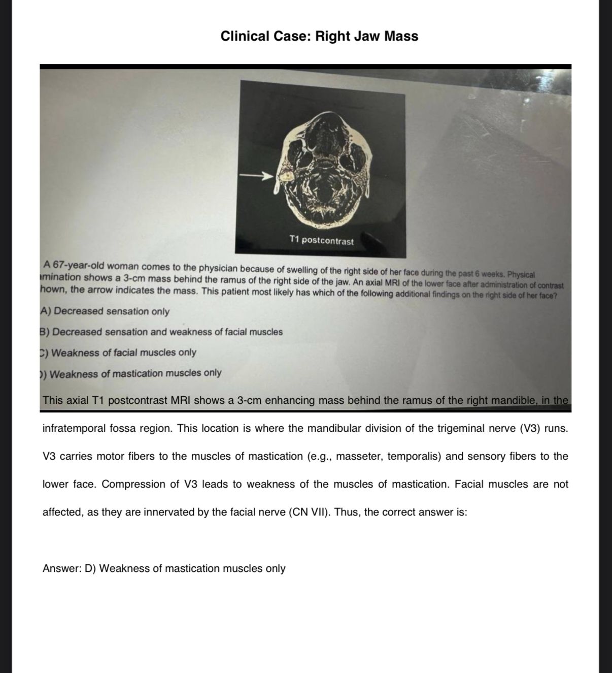 CBSE NBME Premium Recalls/Past Papers Package 2024-2025: Score Boosting Guidance & Bonus Resources Included"